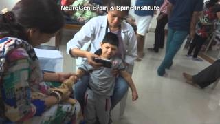 Treatment for Spastic Quadriplegia Cerebral Palsy [upl. by Ky]