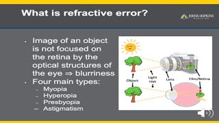 Refractive Error  A Patient Guide to Glasses [upl. by Vanya]