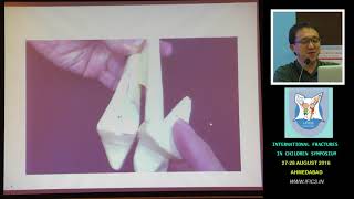 Dr James Hui Triplane and Tillaux Ankle Fractures [upl. by Naujat398]