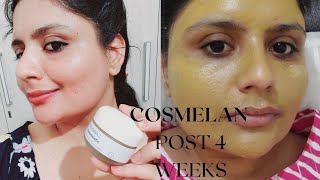 Cosmelan Peel indian skin journey pigmentation skincare aesthetic antiaging [upl. by Gmur171]