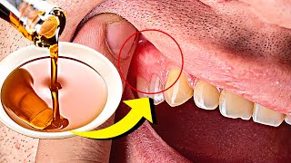 Grow Back Receding Gums Naturally in 2 Weeks [upl. by Rider]