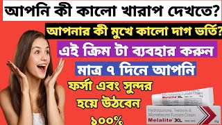 Melalite XL cream ফর্সা হওয়ার ক্রিম full review in bangla uses price dosage [upl. by Schnell826]