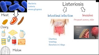 listeriosis  Symptoms and treatment Listeria monocytogenes [upl. by Sarah]