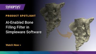 AIEnabled Bone Filling Filter in Simpleware Software [upl. by Notsirk498]