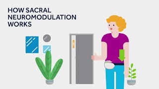 What is Sacral Neuromodulation SNM [upl. by Elletnuahs]