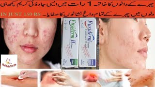 Fusiderm Cream Uses In urdu  Fusiderm Cream How to Use  Best product for you [upl. by Okram]