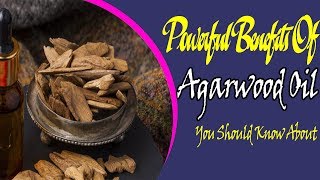 Powerful Benefits Of Agarwood Oil You Should Know About  Useful info [upl. by Huesman751]