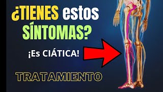 TODOS LOS SÍNTOMAS DE LA CIÁTICA Y CÓMO CURARLA [upl. by Vaientina]