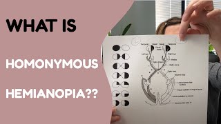 What is Homonymous Hemianopia [upl. by Grube473]