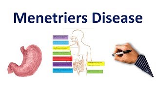 Menetriers Disease Made Easy USMLE Step 1 NCLEX COMLEX [upl. by Atik316]