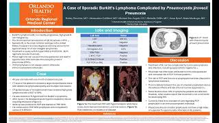 A Case of Sporadic Burkitt’s Lymphoma Complicated by Pneumocystis jirovecii Pneumonia [upl. by Gem]