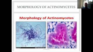 Actinomycetes and Nocardia Diverse Group of Gram Positive Bacilli [upl. by Airdnaed]