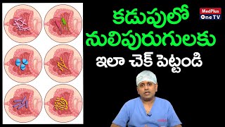 Intestinal Worms  Symptoms Treatment and Causes  DrKShiva Raju MedPlusONETV [upl. by Adahsar]