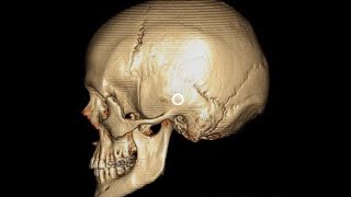 ANATOMIE FMPM OSTÉOLOGIE DU CRANE VS22 [upl. by Alikahs]