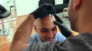 Inside Look Scalp Micropigmentation Treatment  Scalp Micro USA [upl. by Dwinnell]