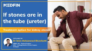 Treatment Options For Ureteric stones [upl. by Colton]