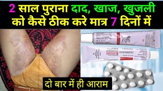 2 साल पुराने दाद खाज खुजली को कैसे ठीक करें  fungal infection in private parts  khujli ki dawa [upl. by Lidstone]