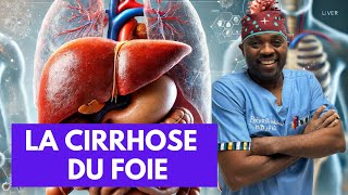 Tout ce que vous devez savoir sur La cirrhose du foie par docteursourire [upl. by Pedaiah]