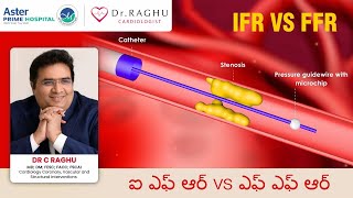 What is IFR  IFR Vs FFR  Dr Raghu  Aster Prime Hospital [upl. by Anilosi84]