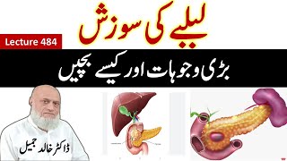 Inflammation of pancreas  How to protect  lecture 484 [upl. by Antone]