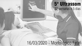 5° Ultrassom  22 semanas e 5 dias  Morfológico [upl. by Adnilreh]