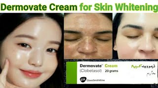 Dermovate Cream for Skin Whitening  dermovate cream ke Fayde  Dermovate cream Uses [upl. by Danyelle662]