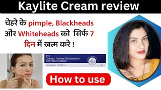 Clinmiskin Gel Uses in Hindi  Clindamycin Phosphate amp Nicotinamide Gel  how To Use  Side Effects [upl. by Kinata]