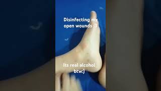 Disinfection disinfectant wounds shorts [upl. by Ahsiken]