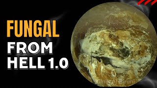 FUNGAL FROM HELL 10 [upl. by Lattimer]