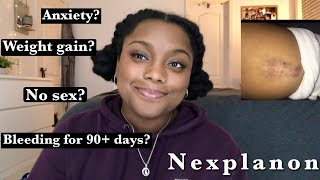 MY EXPERIENCE ON NEXPLANON weight gain regrets bleeding [upl. by Warthman]