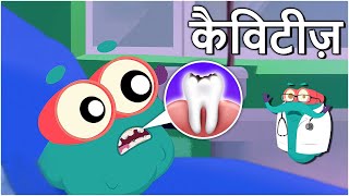 कैविटीज़  दांतों में कीड़े  Cavities In Hindi  DrBinocs Show  Educational Videos For Kids [upl. by Annawek371]