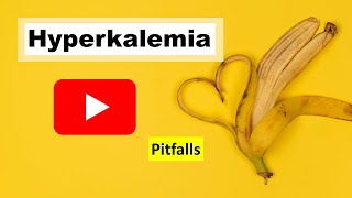 Hyperkalemia Management [upl. by Belicia748]