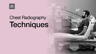 Chest Radiography Techniques [upl. by Carmita]