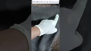 PVNB in cowparavertebral nerve block [upl. by Esaertal476]