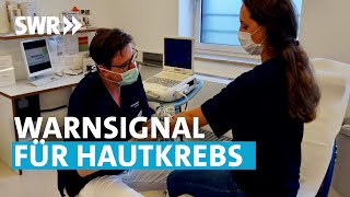 Hautausschlag als Anzeichen von Krebs  Rundum gesund [upl. by Uhayile]