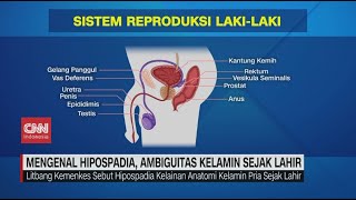 Mengenal Hipospadia Ambiguitas Kelamin Sejak Lahir [upl. by Ahsener256]