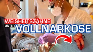 VOLLNARKOSE ALLE 4 WEISHEITSZÄHNE ZIEHEN Zahnarzt [upl. by Sanson]