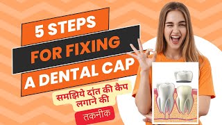 दांतो पर कैप लगाने की तकनीक DENTAL CAP LAGANE KI TAKNEEK Tooth cap fixing procedure in steps [upl. by Denney]