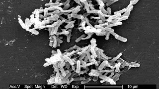 Do health treatments aimed at gut bacteria work [upl. by Luttrell]