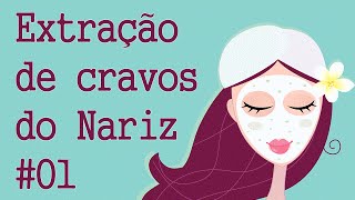 Extração de cravos do Nariz 01  Limpeza de Pele Profunda  Clínica  Centro estética [upl. by Bac]