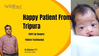 Cleft Lip Surgery Success Story  Testimonial from North East India  Dr Mathew PC [upl. by Eninej403]