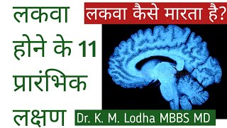 लकवा पैरालिसिस होने के लक्षण  लकवा क्या होता है  11 Early sign amp Symptoms of paralysis in Hindi [upl. by Cindelyn]