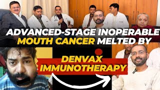 AdvancedStage Inoperable Mouth Cancer Melted by Denvax Immunotherapy Dr Jamal A Khan DENVAX [upl. by Kcirddec]