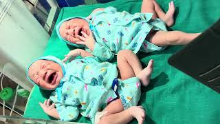 New baby newborn baby two baby 👶❤️🔥shortvideo doctorbantu shorts [upl. by Honoria]