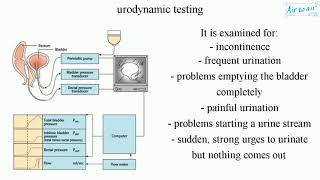 urodynamic testing [upl. by Nyved]