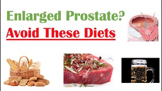 Foods to Avoid with Enlarged Prostate  Reduce Symptoms and Risk of Prostate Cancer [upl. by Princess]