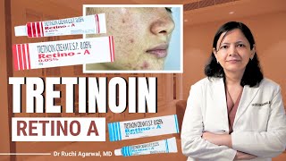 Tretinoin cream  Tretinoin Cream for Acne  Tretinoin cream 005  Dr Ruchi Agarwal  tretinoin [upl. by Einot467]