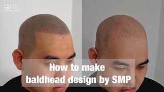 Scalp Tattoo technique for baldhead by scalp design center [upl. by Chiaki]