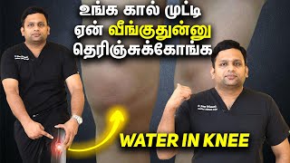 Explains Water in the Knee Dr Shriram krishnamoorthy  Tamil [upl. by Cecile]