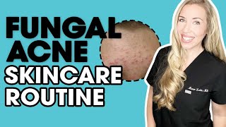 Fungal Acne Skincare Routine  Musthave Products  The Budget Dermatologist [upl. by Serle]